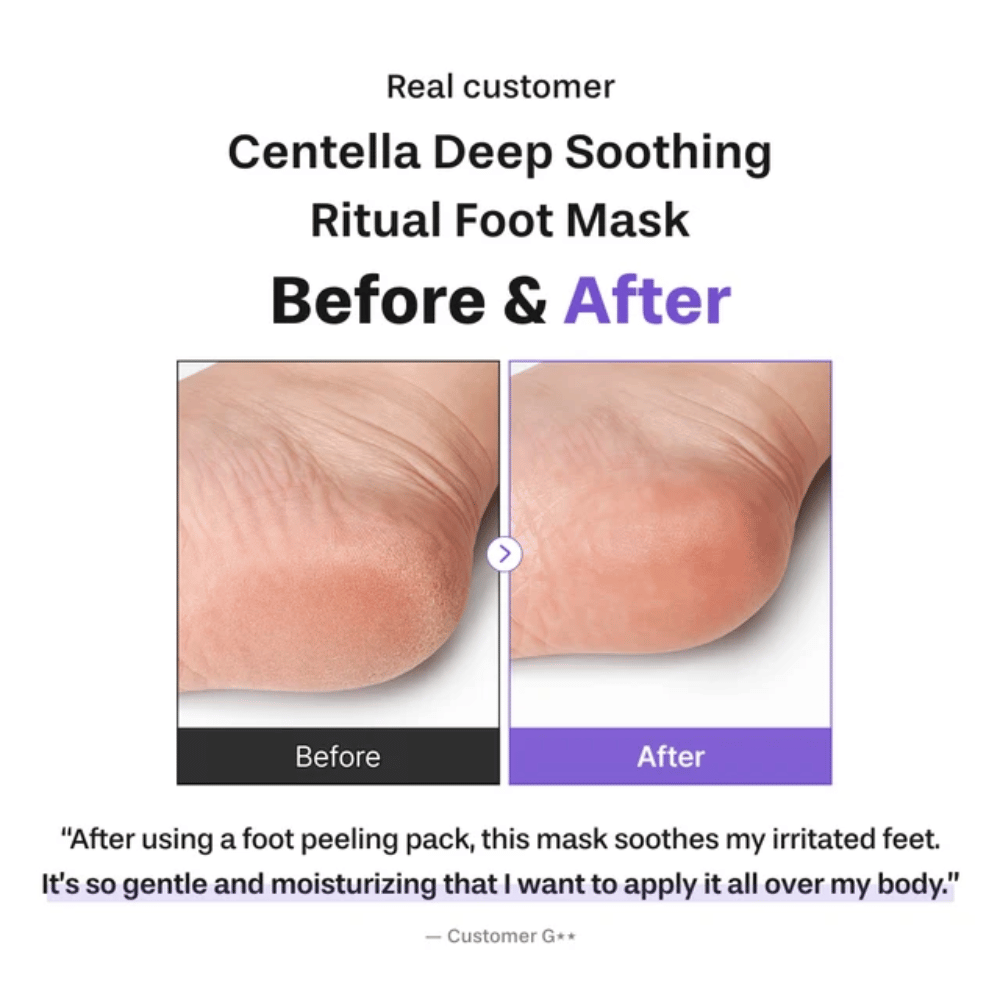 6. Baren Centella Deep Soothing Ritual Foot Mask – före- och efterbild som visar en mjukare och mer återfuktad häl efter användning