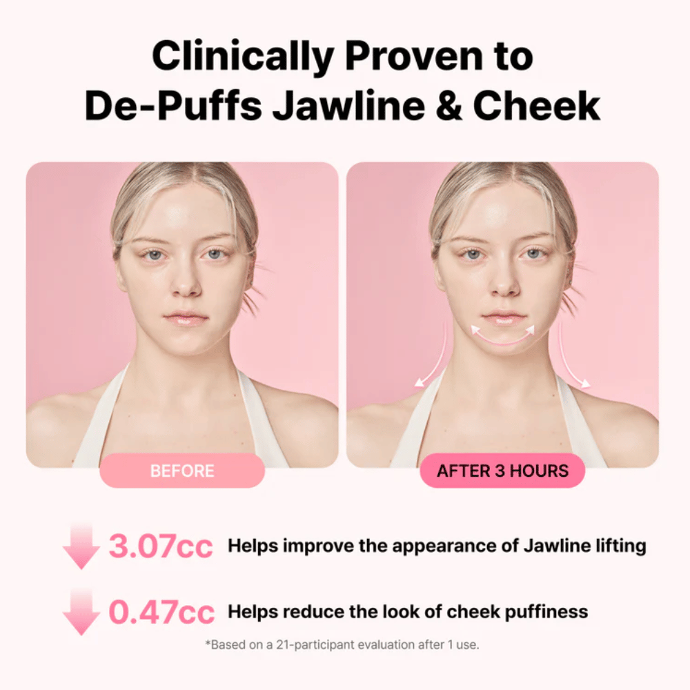 Före- och efterbild som illustrerar förbättrat utseende av käklinje och minskad svullnad efter användning av RETURNITY Ear Therapy Acupressure Patch under tre timmar.