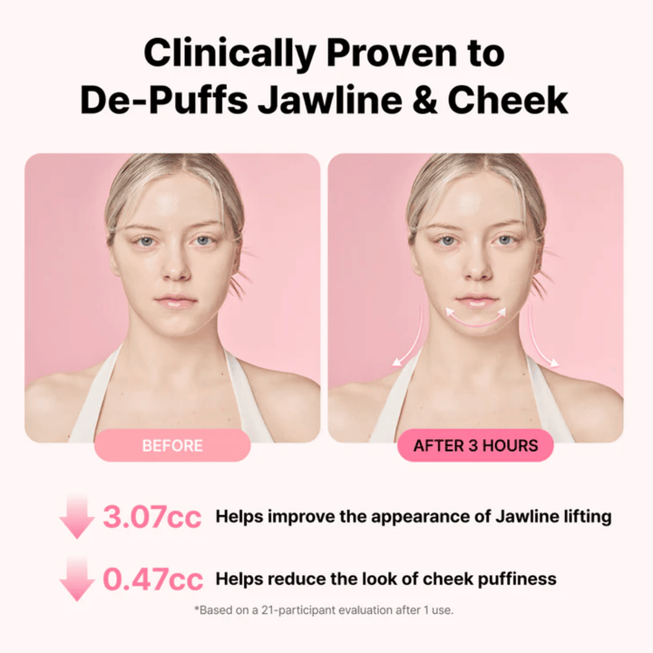 Före- och efterbild som illustrerar förbättrat utseende av käklinje och minskad svullnad efter användning av RETURNITY Ear Therapy Acupressure Patch under tre timmar.