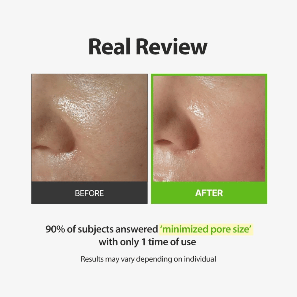 SUNGBOON EDITOR Green Tomato Pore Peeling Jumbo Pad – före- och efterbild med fokus på synliga porer