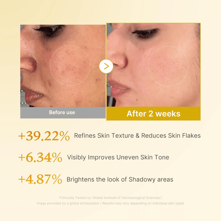Före- och efterbild för Medicube Kojic Acid Turmeric Resurfacing Toner som visar förbättrad hudtextur, jämnare hudton och minskade torra hudflagor efter två veckors användning.