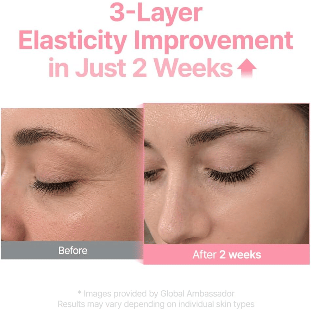 Före- och efterbild för Purito Multi PDRN Collagen EGF Serum som visar förbättrad hudelasticitet efter två veckor.