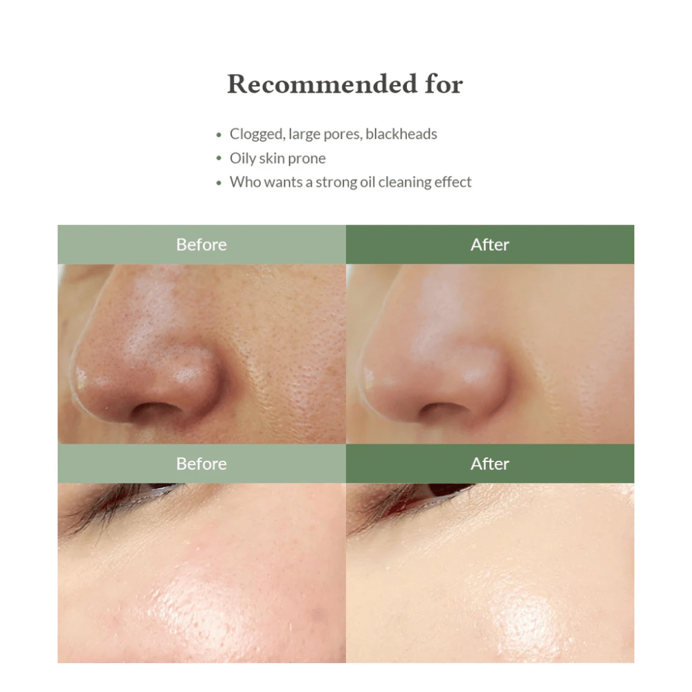 Dr. Althea Premium Quick Step Sebum Cleanser – ansiktsrengöring som hjälper till att minska pormaskar, rengöra porer på djupet och ge en jämnare hudstruktur.