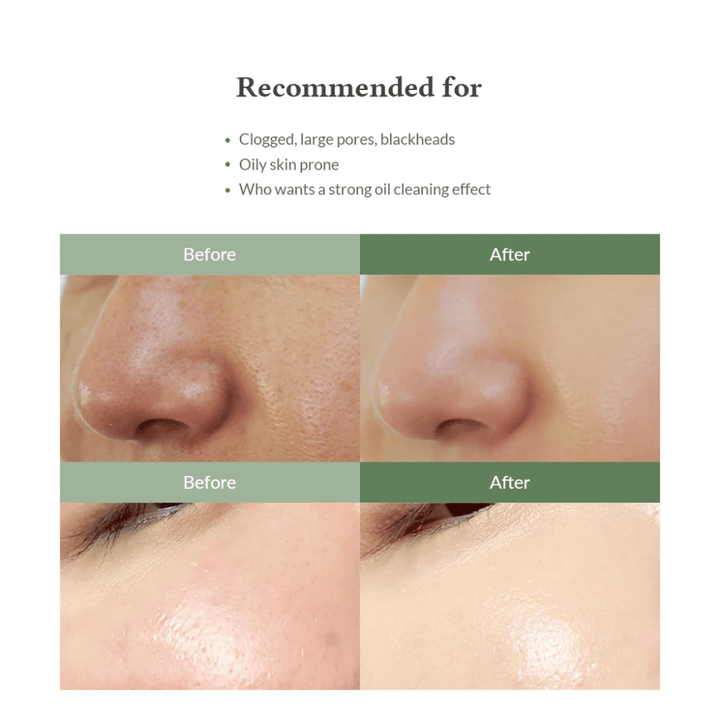 Dr. Althea Premium Quick Step Sebum Cleanser – ansiktsrengöring som hjälper till att minska pormaskar, rengöra porer på djupet och ge en jämnare hudstruktur.