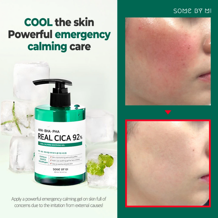 Kraftfull akut lugnande vård för huden med SOME BY MI AHA, BHA, PHA Real Cica 92% Cool Calming Soothing Gel 300ml.